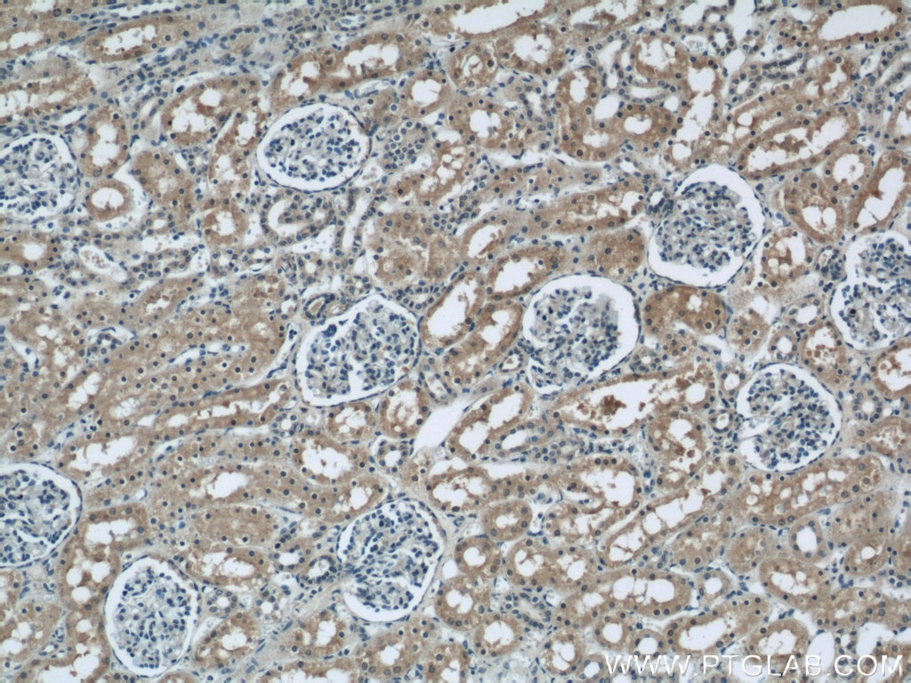 Immunohistochemistry (IHC) staining of human kidney tissue using CBY1 Polyclonal antibody (12239-1-AP)