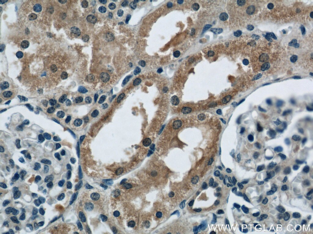 Immunohistochemistry (IHC) staining of human kidney tissue using CBY1 Polyclonal antibody (12239-1-AP)