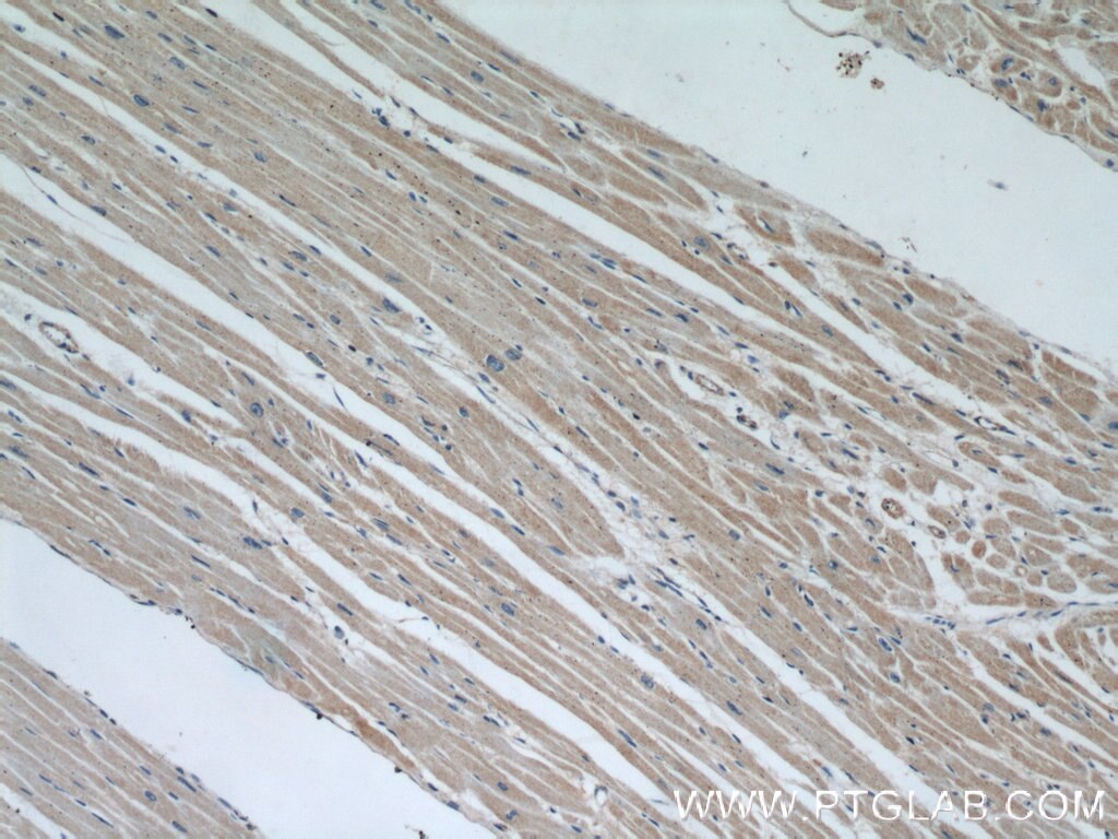 Immunohistochemistry (IHC) staining of human heart tissue using CBY1 Polyclonal antibody (12239-1-AP)