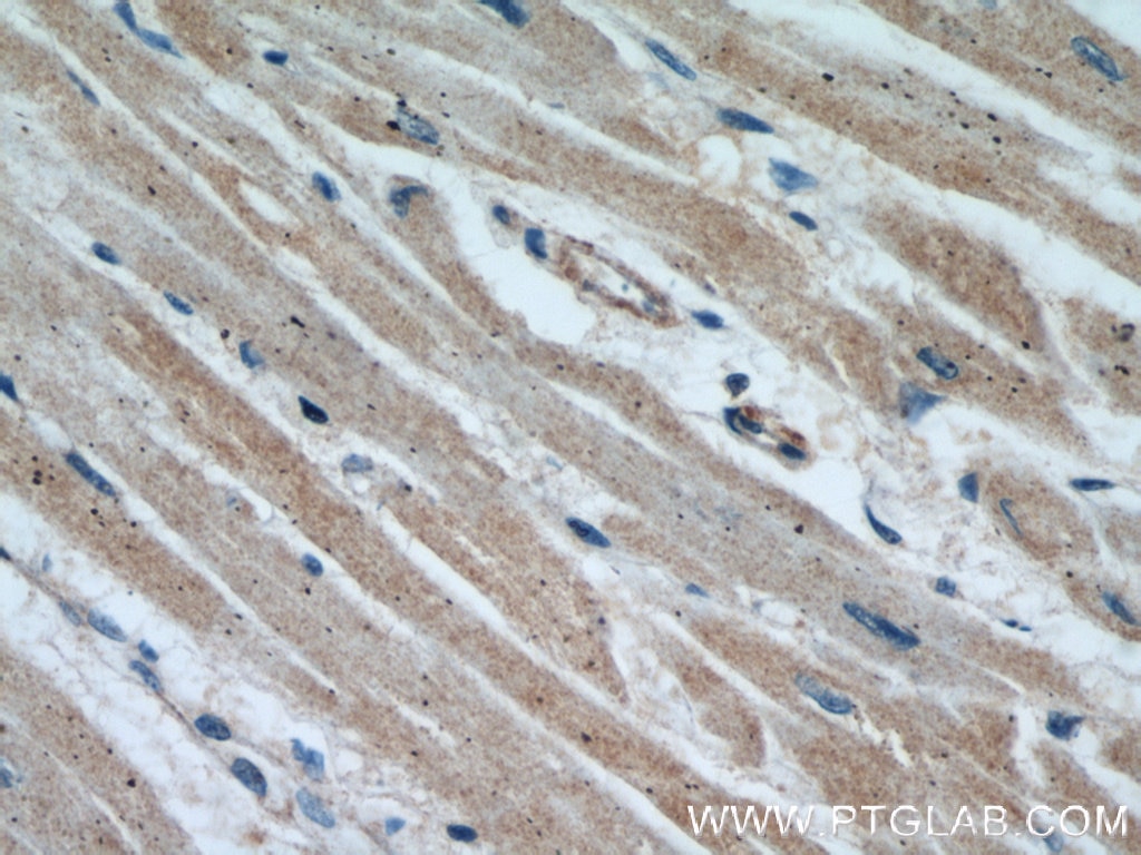 Immunohistochemistry (IHC) staining of human heart tissue using CBY1 Polyclonal antibody (12239-1-AP)