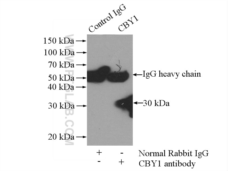 Immunoprecipitation (IP) experiment of mouse liver tissue using CBY1 Polyclonal antibody (12239-1-AP)