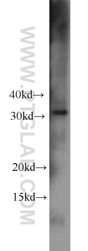 Western Blot (WB) analysis of mouse kidney tissue using CBY1 Polyclonal antibody (12239-1-AP)