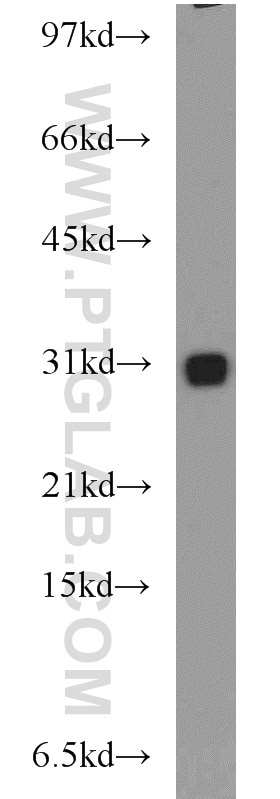 Western Blot (WB) analysis of mouse liver tissue using CBY1 Polyclonal antibody (12239-1-AP)