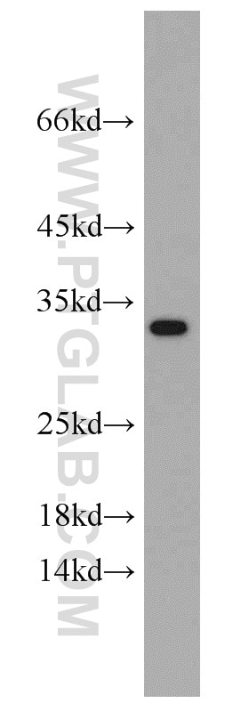 Western Blot (WB) analysis of mouse liver tissue using CBY1 Polyclonal antibody (12239-1-AP)
