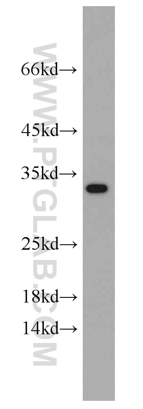 WB analysis of mouse liver using 12239-1-AP