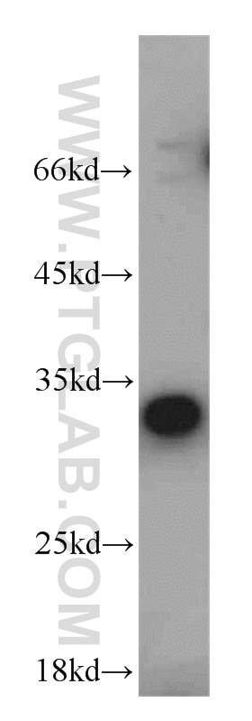 Western Blot (WB) analysis of mouse kidney tissue using CBY1 Polyclonal antibody (12239-1-AP)