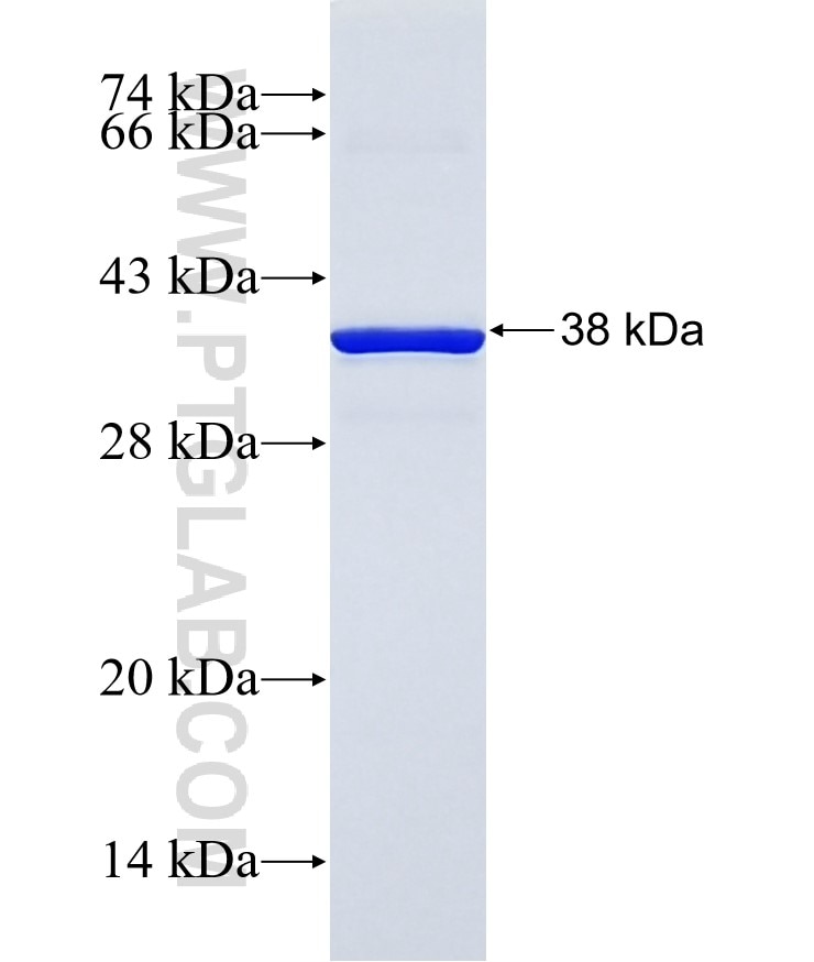 CBY3 fusion protein Ag31541 SDS-PAGE