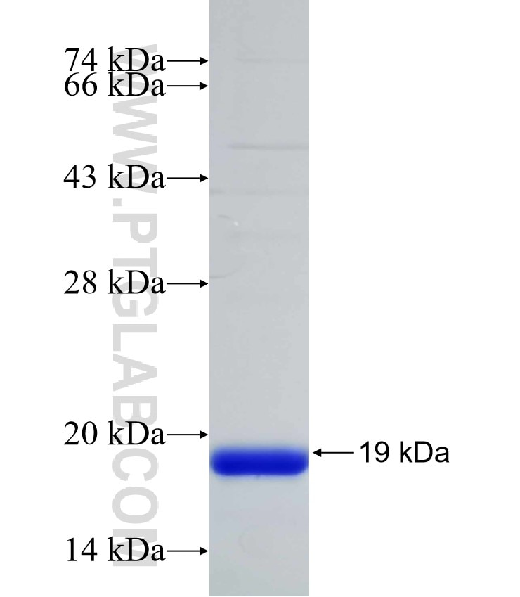 CBY3 fusion protein Ag31599 SDS-PAGE CBY3 fusion protein Ag31599 SDS-PAGE