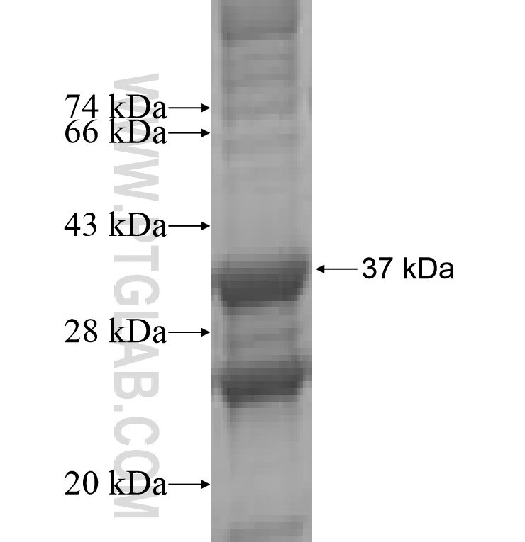 CC10 fusion protein Ag7913 SDS-PAGE
