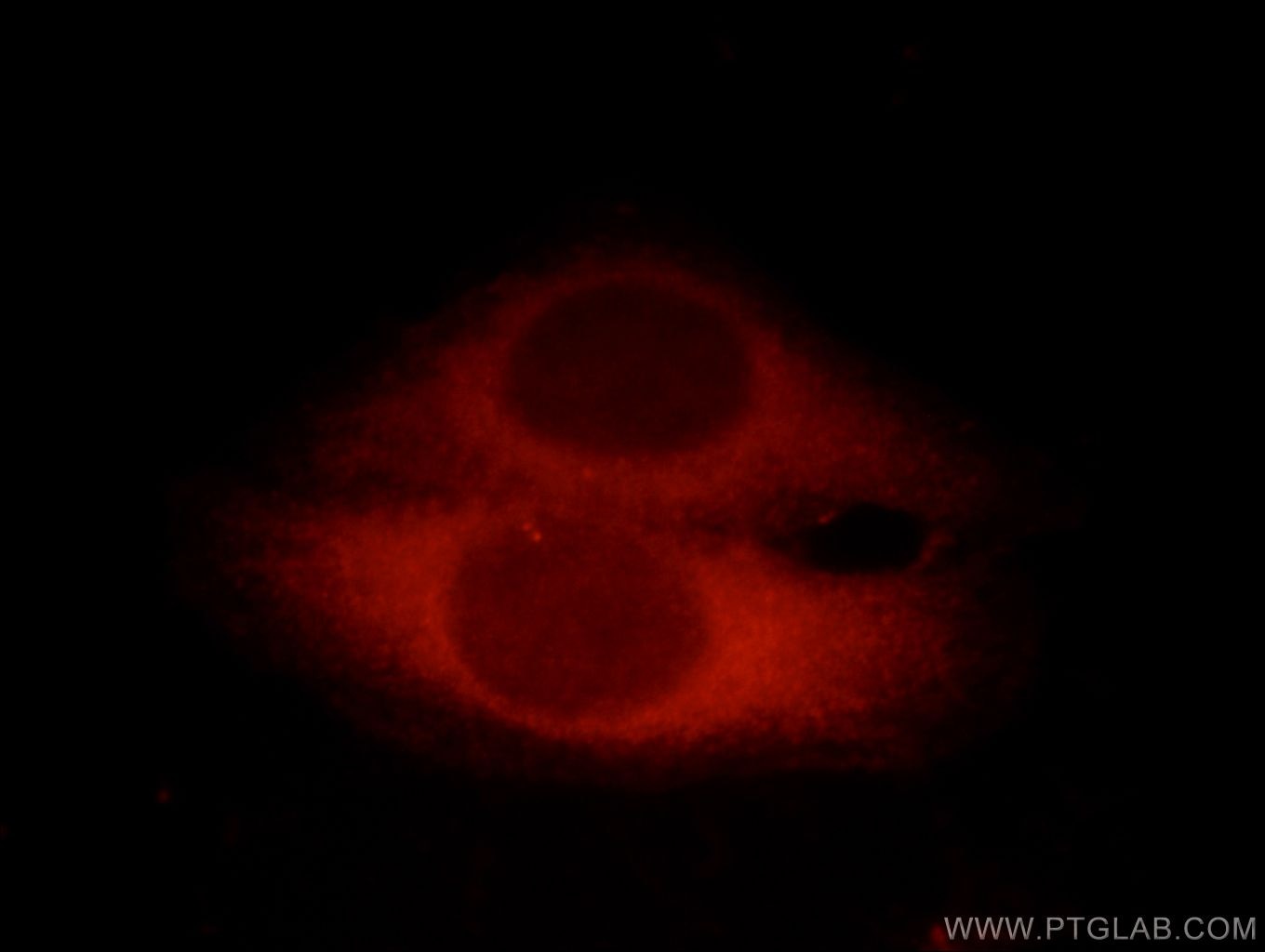 Immunofluorescence (IF) / fluorescent staining of HepG2 cells using CC2D1A Polyclonal antibody (16816-1-AP)