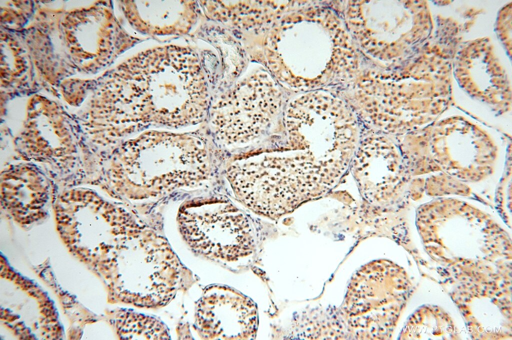 IHC staining of human testis using 16816-1-AP