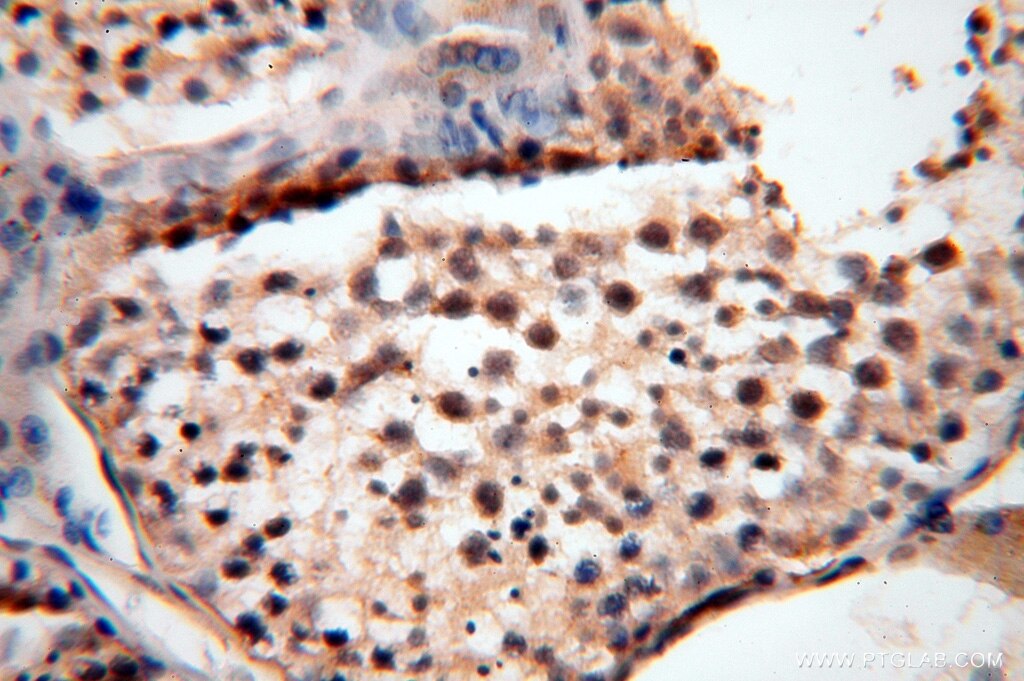 Immunohistochemistry (IHC) staining of human testis tissue using CC2D1A Polyclonal antibody (16816-1-AP)