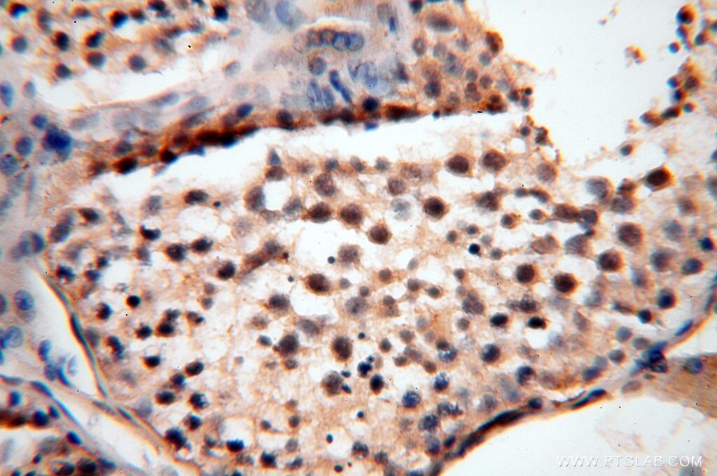 IHC staining of human testis using 16816-1-AP