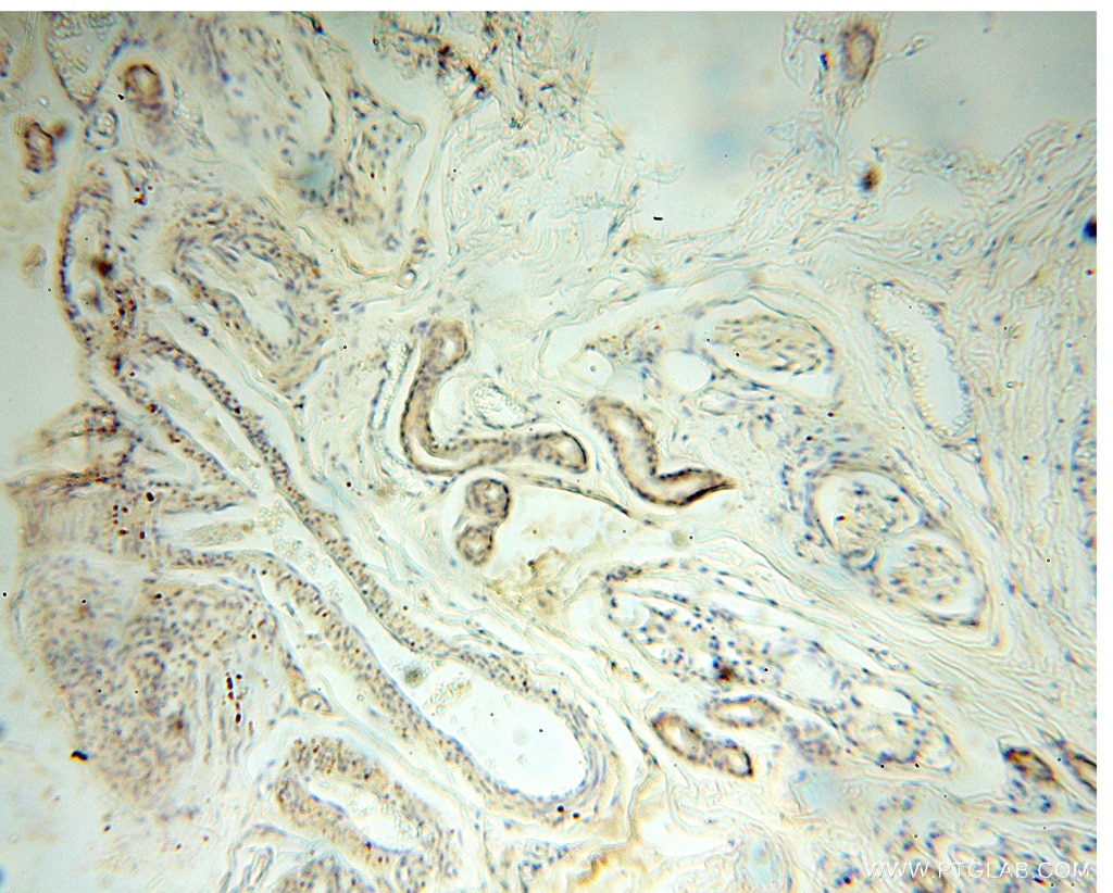 Immunohistochemistry (IHC) staining of human skin tissue using CC2D1A Polyclonal antibody (16816-1-AP)