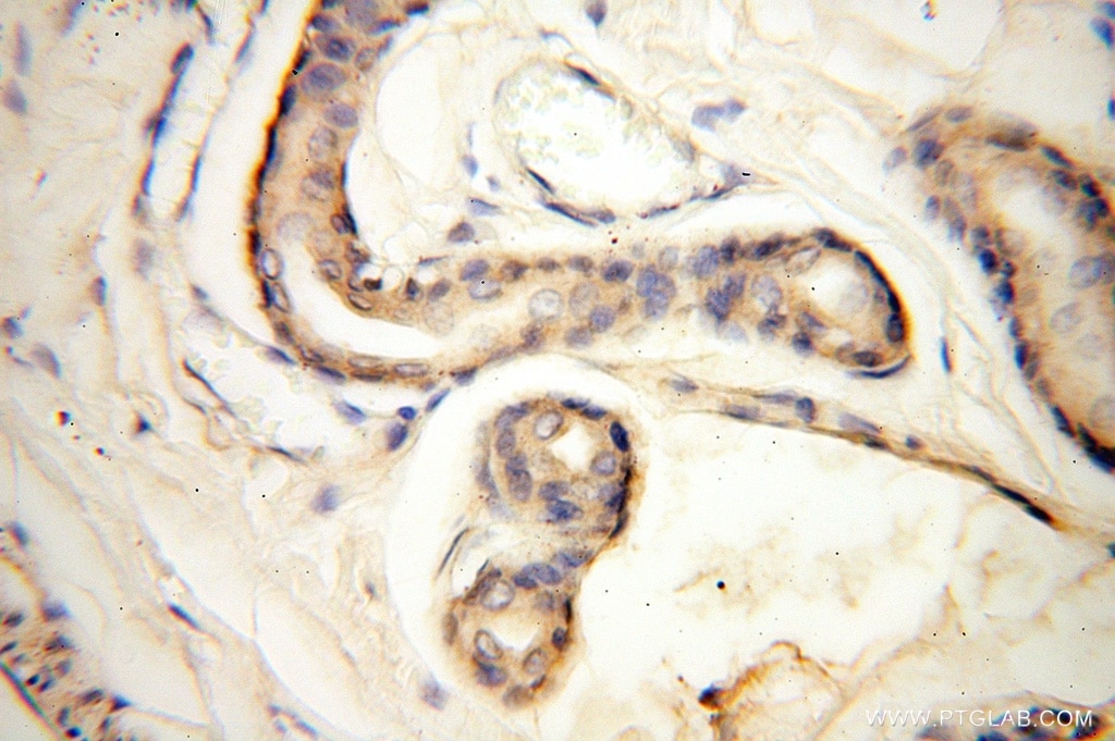 Immunohistochemistry (IHC) staining of human skin tissue using CC2D1A Polyclonal antibody (16816-1-AP)