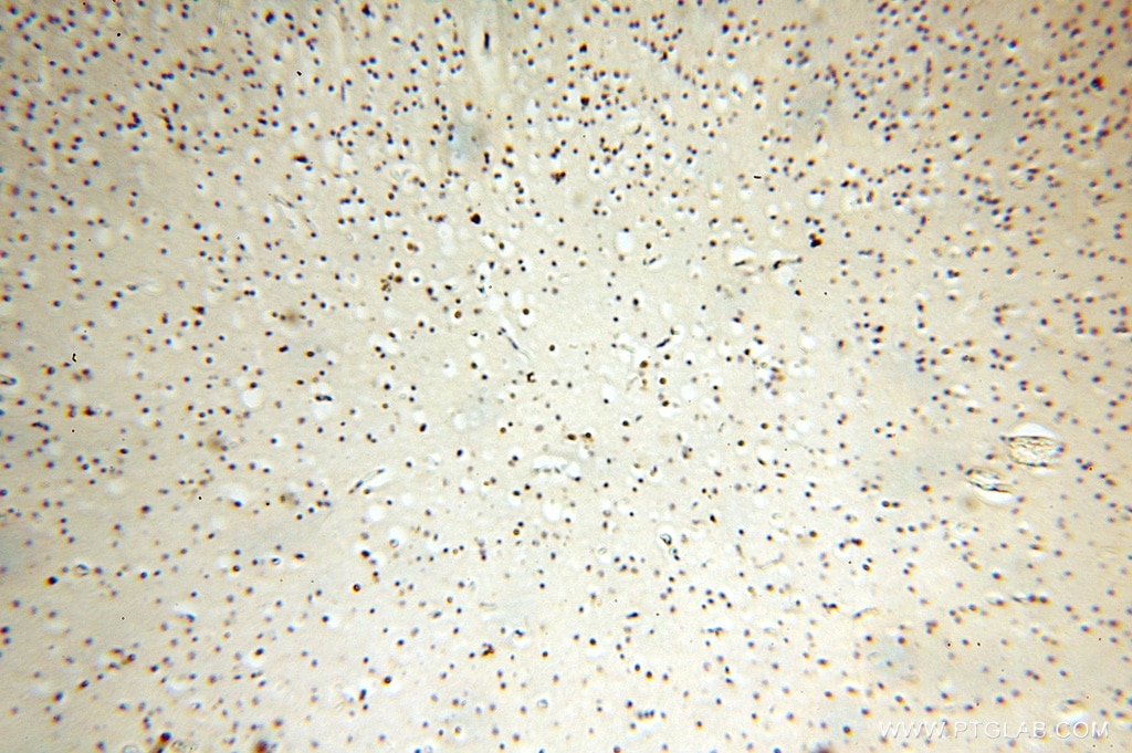 Immunohistochemistry (IHC) staining of human brain tissue using CC2D1A Polyclonal antibody (16816-1-AP)