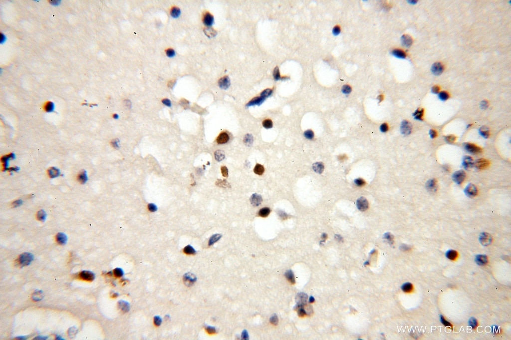 Immunohistochemistry (IHC) staining of human brain tissue using CC2D1A Polyclonal antibody (16816-1-AP)