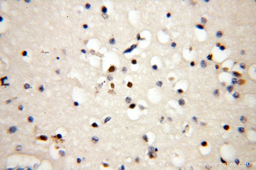 Immunohistochemistry (IHC) staining of human brain tissue using CC2D1A Polyclonal antibody (16816-1-AP)