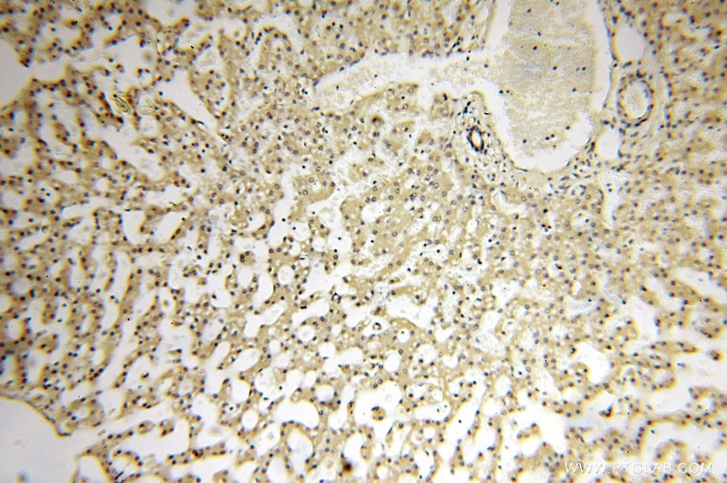 Immunohistochemistry (IHC) staining of human liver tissue using CC2D1A Polyclonal antibody (16816-1-AP)
