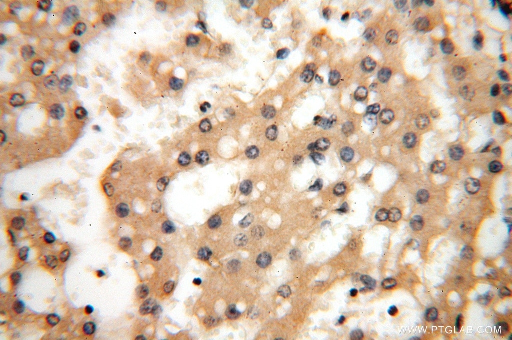Immunohistochemistry (IHC) staining of human liver tissue using CC2D1A Polyclonal antibody (16816-1-AP)