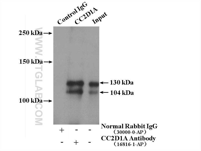 Immunoprecipitation (IP) experiment of mouse liver tissue using CC2D1A Polyclonal antibody (16816-1-AP)