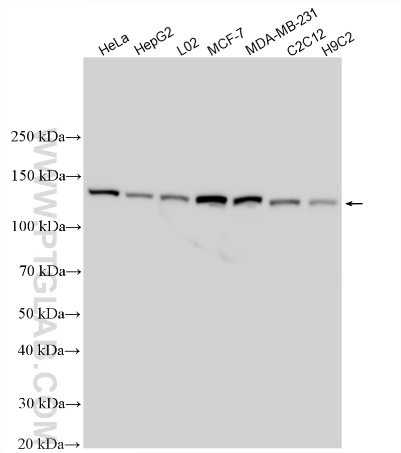 Various lysates were subjected to SDS PAGE followed by western blot with 16816-1-AP (CC2D1A antibody) at dilution of 1:80000 incubated at room temperature for 1.5 hours. Western Blot (WB) analysis of various lysates using CC2D1A Polyclonal antibody (16816-1-AP)