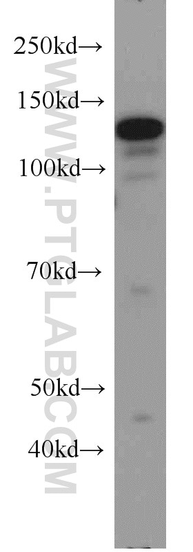 Western Blot (WB) analysis of HeLa cells using CC2D1A Polyclonal antibody (16816-1-AP)