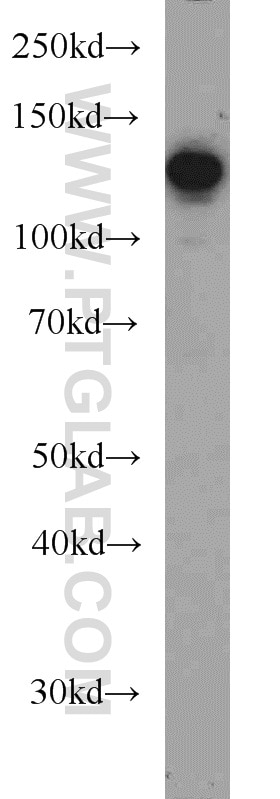 Western Blot (WB) analysis of HEK-293 cells using CC2D1A Polyclonal antibody (16816-1-AP)