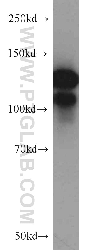 Western Blot (WB) analysis of HeLa cells using CC2D1A Polyclonal antibody (16816-1-AP)