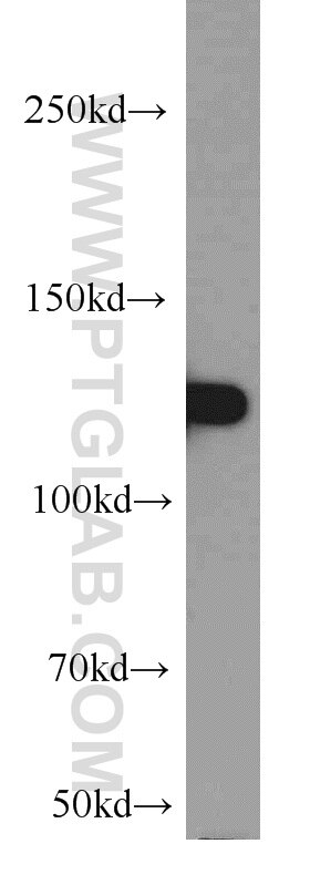 Western Blot (WB) analysis of mouse liver tissue using CC2D1A Polyclonal antibody (16816-1-AP)