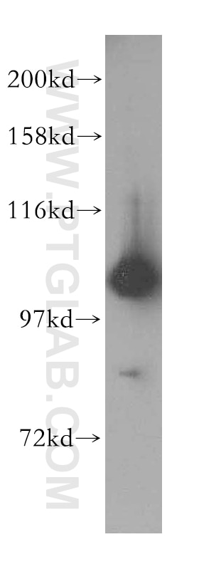 Western Blot (WB) analysis of Jurkat cells using CC2D1A Polyclonal antibody (16816-1-AP)