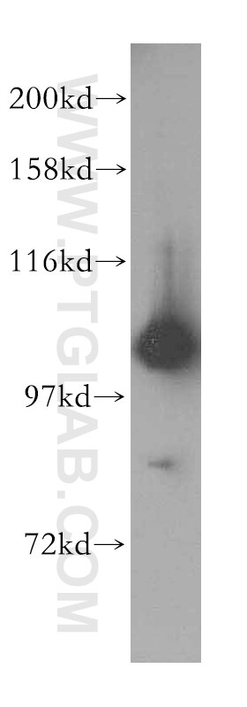 WB analysis of Jurkat using 16816-1-AP