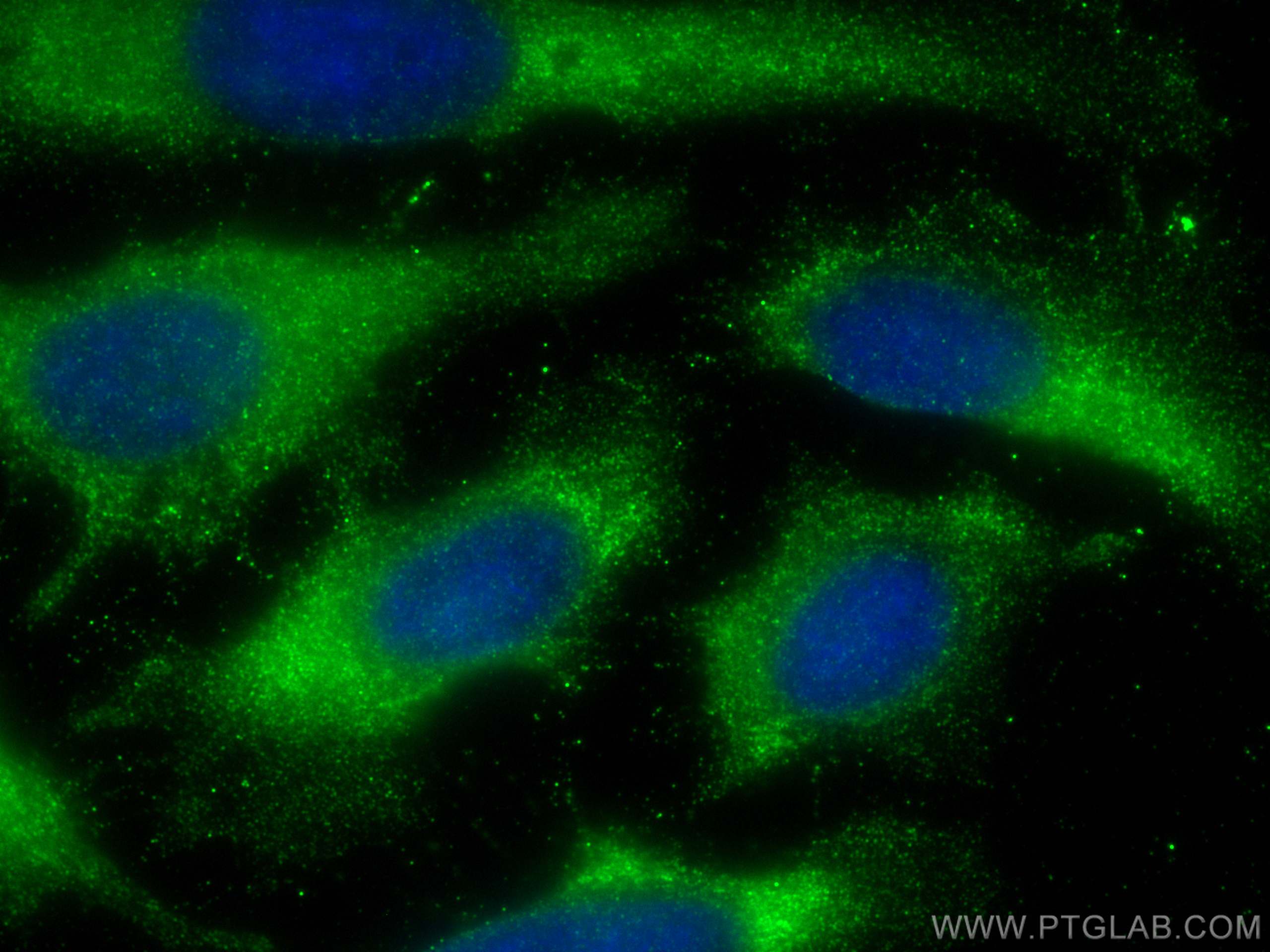 Immunofluorescence (IF) / fluorescent staining of HeLa cells using CC2D1A Monoclonal antibody (68334-1-Ig)