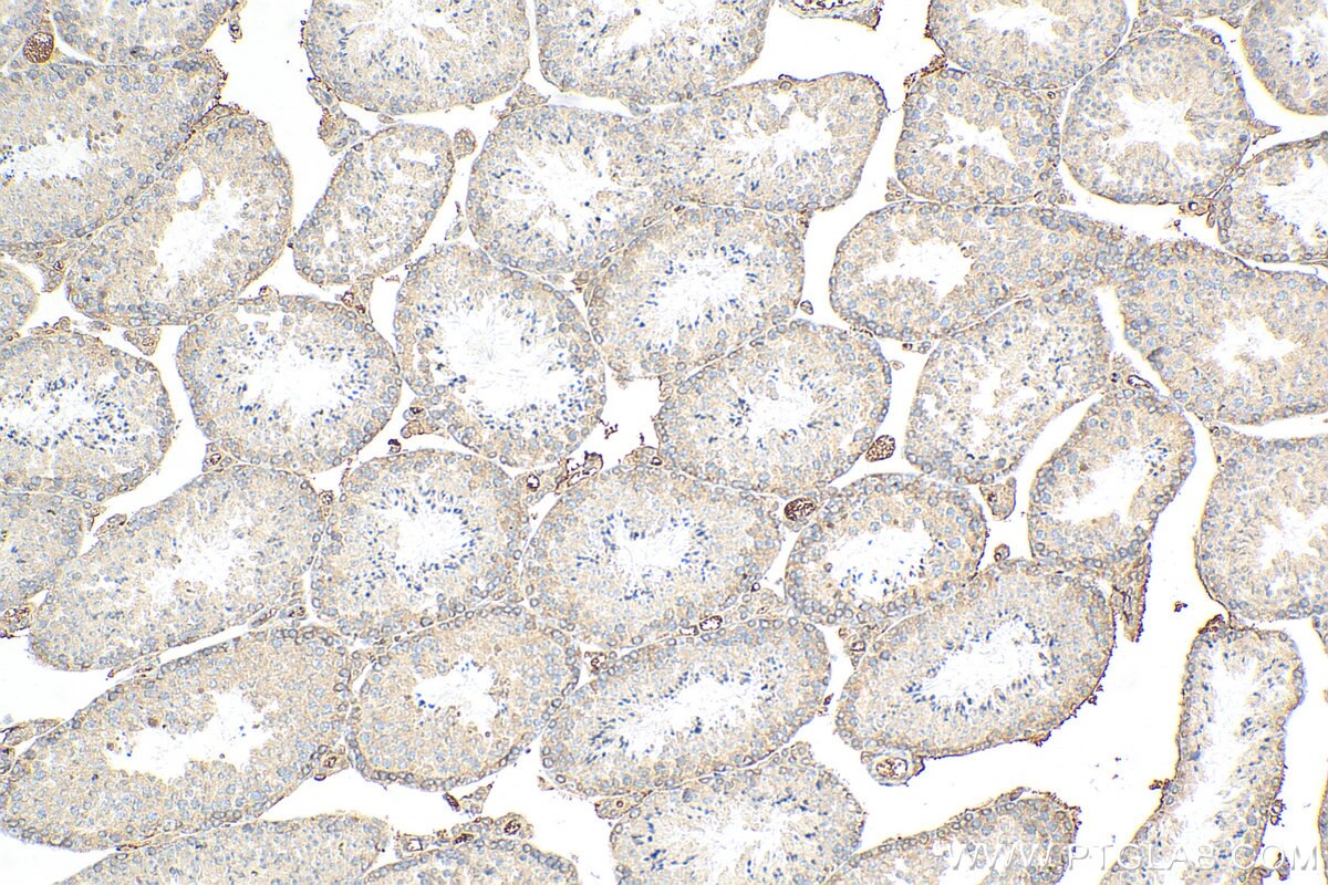 Immunohistochemistry (IHC) staining of mouse testis tissue using CC2D1A Monoclonal antibody (68334-1-Ig)