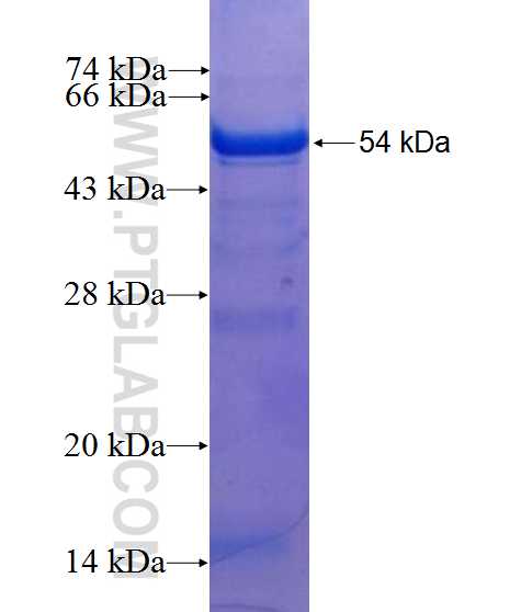 CC2D1A fusion protein Ag10363 SDS-PAGE