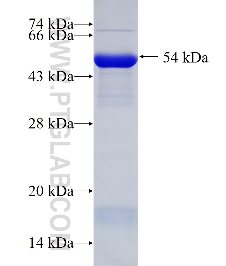 CC2D1A fusion protein Ag10363 SDS-PAGE