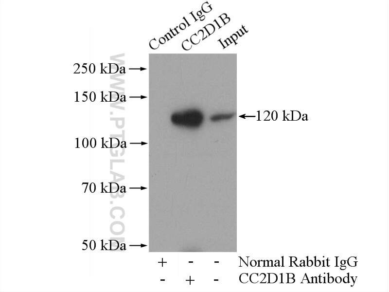 Immunoprecipitation (IP) experiment of mouse brain tissue using CC2D1B Polyclonal antibody (20774-1-AP)