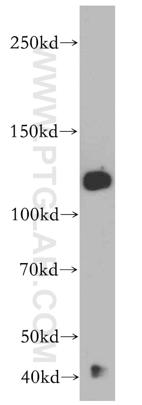 Western Blot (WB) analysis of mouse brain tissue using CC2D1B Polyclonal antibody (20774-1-AP)