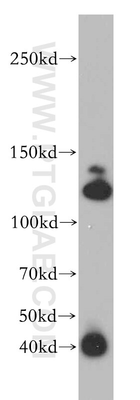 Western Blot (WB) analysis of SH-SY5Y cells using CC2D1B Polyclonal antibody (20774-1-AP)