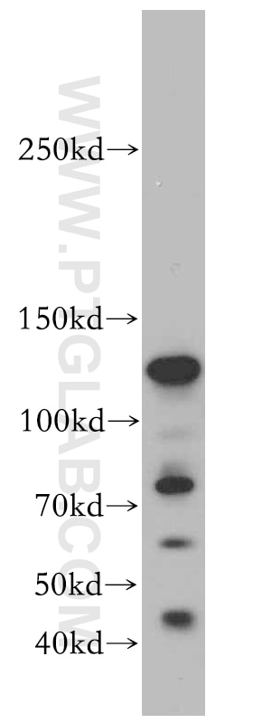 Western Blot (WB) analysis of mouse kidney tissue using CC2D1B Polyclonal antibody (20774-1-AP)
