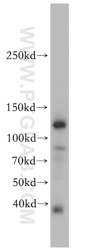 Western Blot (WB) analysis of human placenta tissue using CC2D1B Polyclonal antibody (20774-1-AP)