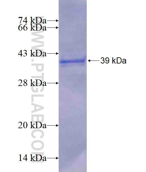 CC2D1B fusion protein Ag14958 SDS-PAGE