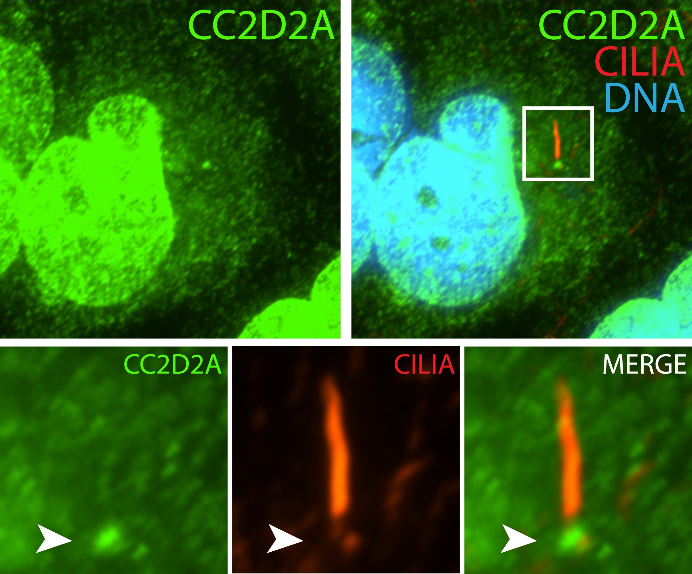 Immunofluorescence (IF) / fluorescent staining of hTERT-RPE1 cells using CC2D2A Polyclonal antibody (22293-1-AP)