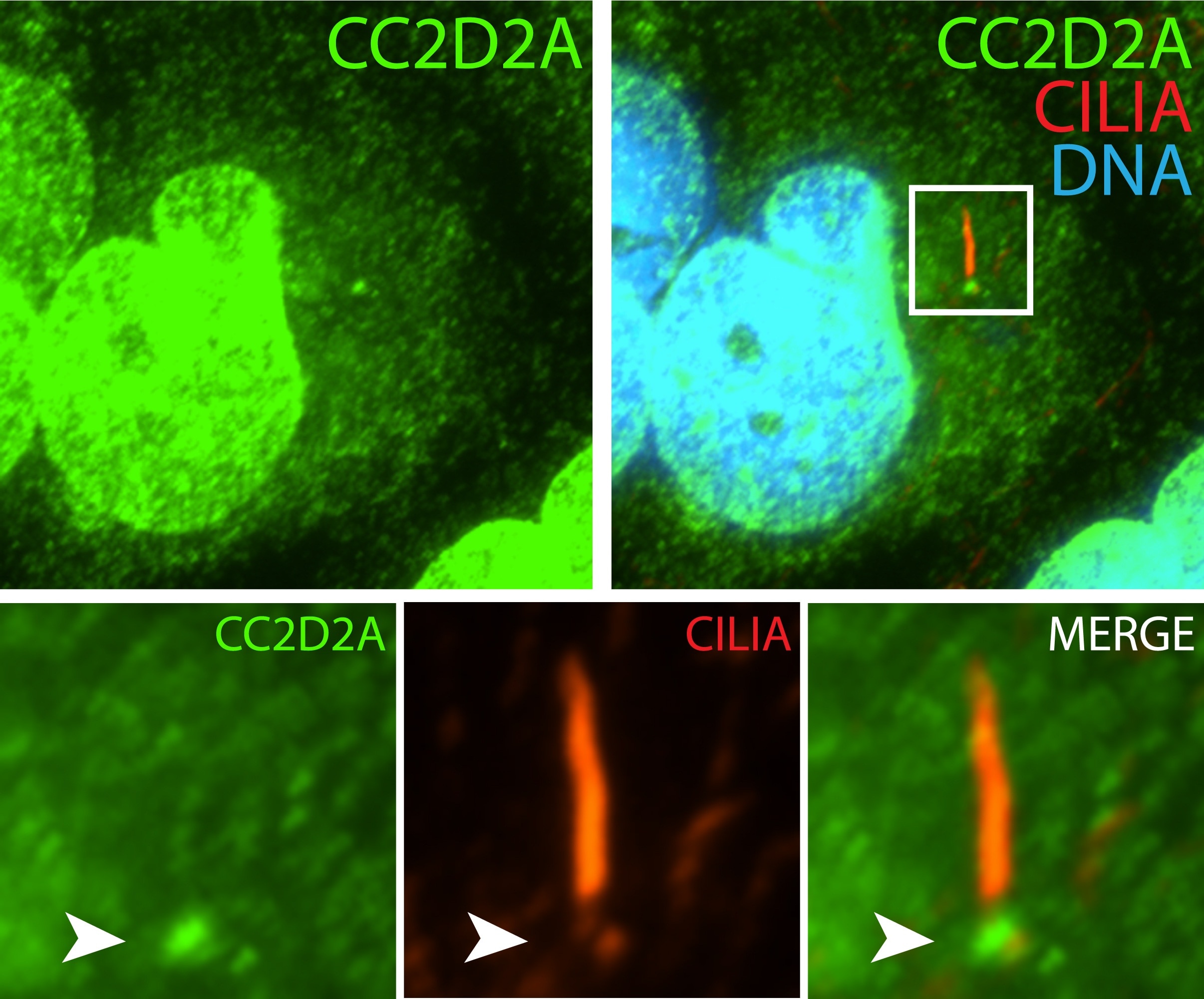 IF Staining of hTERT-RPE1 cells using 22293-1-AP