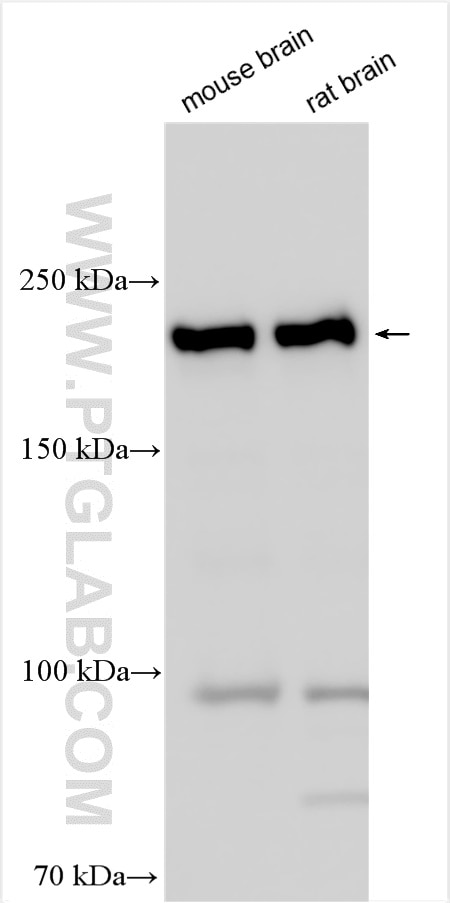 Western Blot (WB) analysis of various lysates using CC2D2A Polyclonal antibody (22293-1-AP)