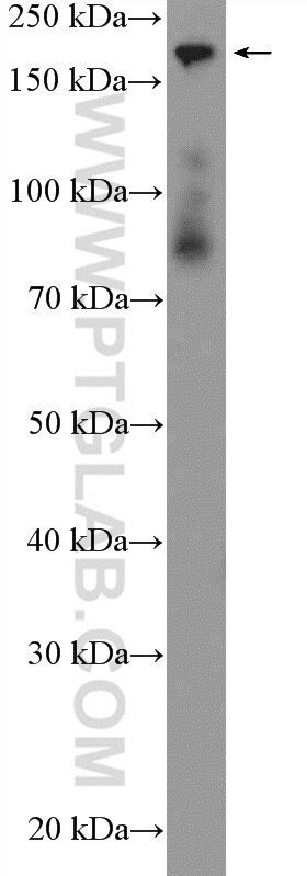 Western Blot (WB) analysis of fetal human brain tissue using CC2D2A Polyclonal antibody (22293-1-AP)
