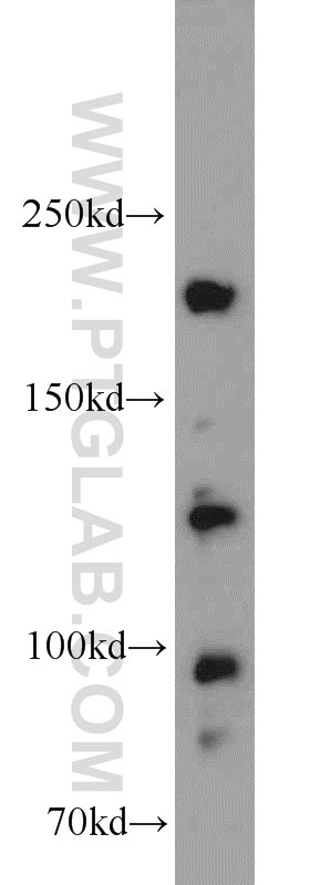 CC2D2A Polyclonal antibody