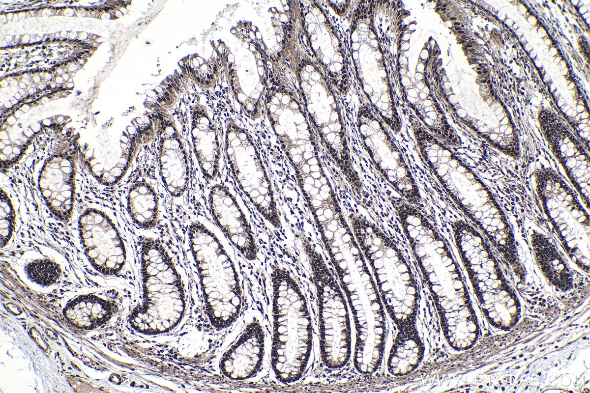 Immunohistochemistry (IHC) staining of human colon tissue using CCAR1 Polyclonal antibody (25232-1-AP)