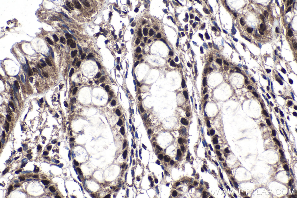 Immunohistochemistry (IHC) staining of human colon tissue using CCAR1 Polyclonal antibody (25232-1-AP)