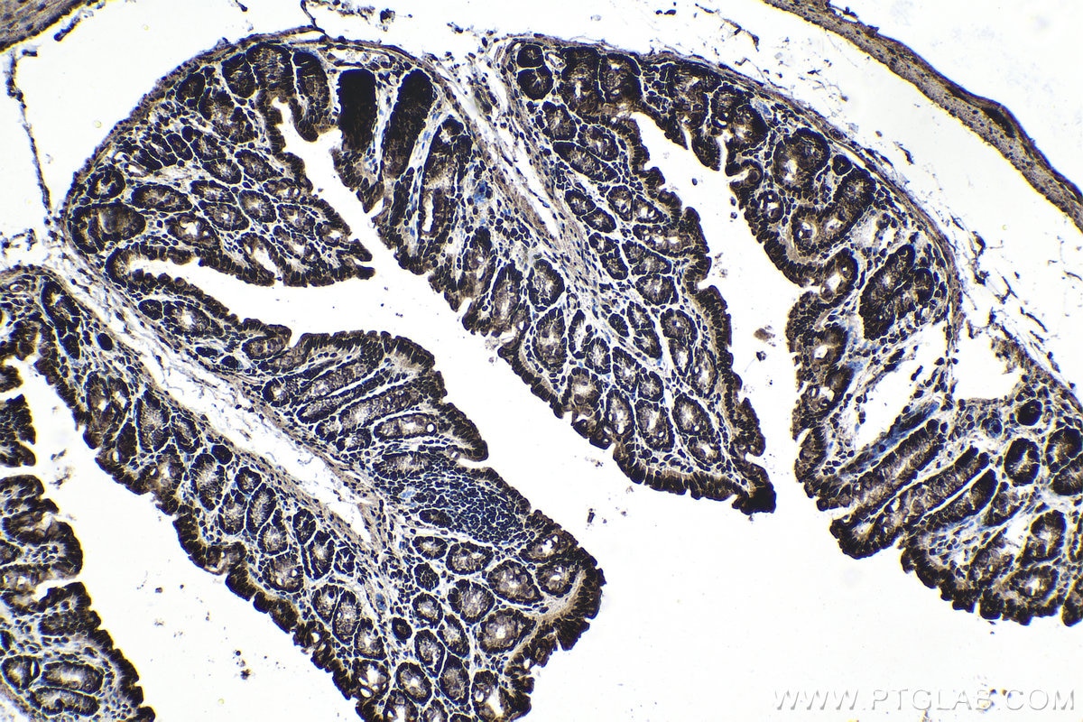 Immunohistochemistry (IHC) staining of mouse colon tissue using CCAR1 Polyclonal antibody (25232-1-AP)